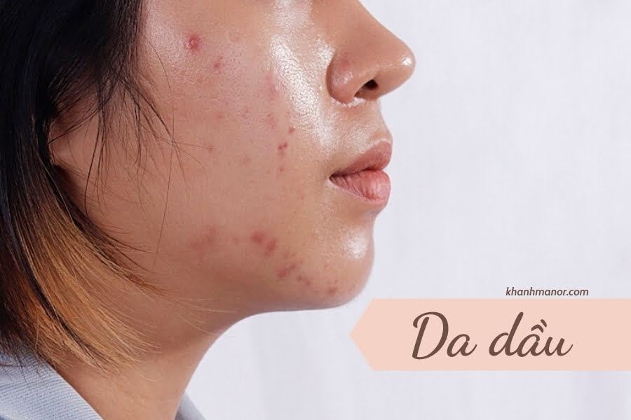 loại da mặt - da dầu