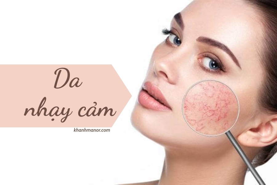 loại da mặt - da nhạy cảm